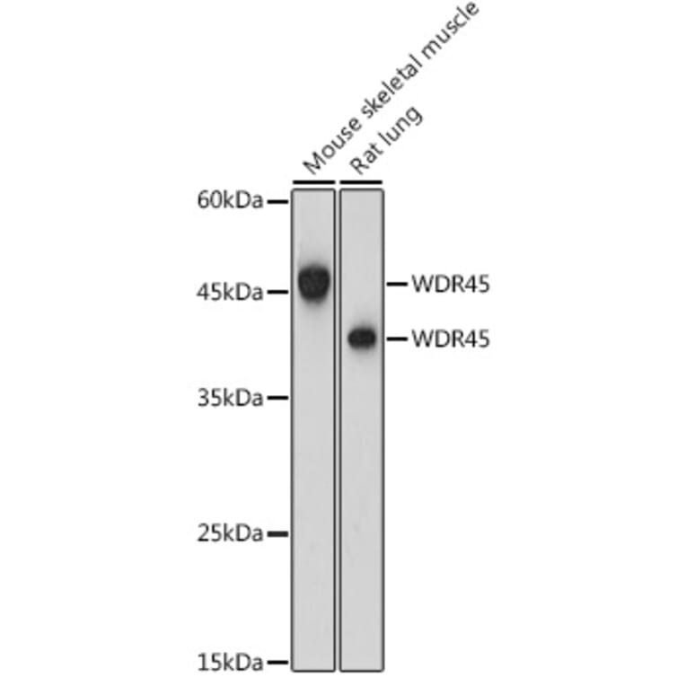 Western Blot - Anti-WDR45 Antibody (A15796) - Antibodies.com