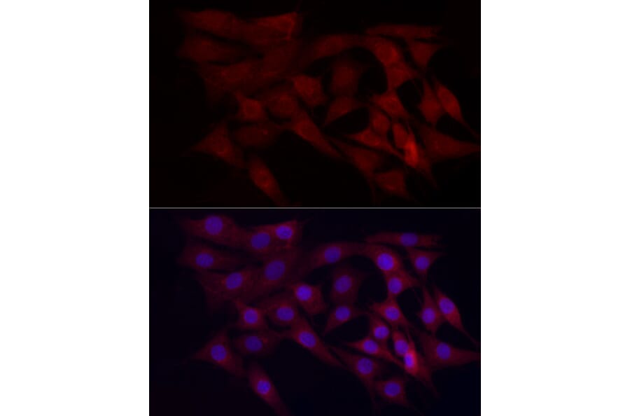 Immunofluorescence - Anti-WDR45 Antibody (A15796) - Antibodies.com