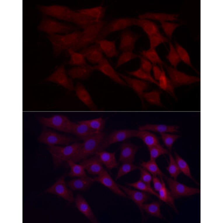Immunofluorescence - Anti-WDR45 Antibody (A15796) - Antibodies.com