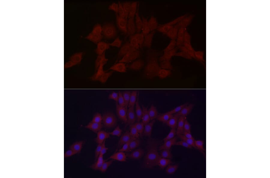 Immunofluorescence - Anti-WDR45 Antibody (A15796) - Antibodies.com