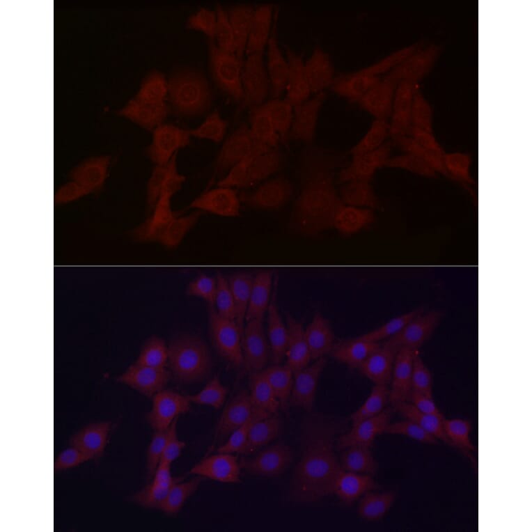 Immunofluorescence - Anti-WDR45 Antibody (A15796) - Antibodies.com