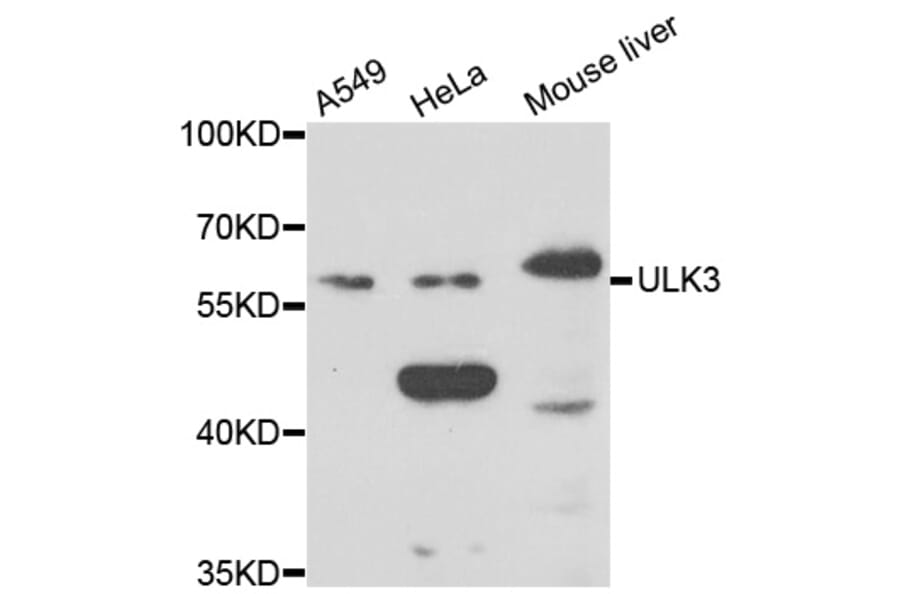 Western Blot - Anti-ULK3 Antibody (A7587) - Antibodies.com