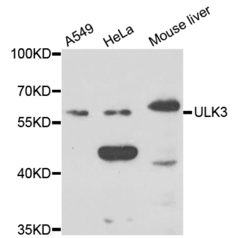 Western Blot - Anti-ULK3 Antibody (A7587) - Antibodies.com