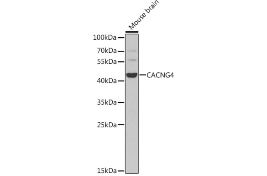 Western Blot - Anti-CACNG4 Antibody (A7588) - Antibodies.com