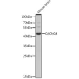 Western Blot - Anti-CACNG4 Antibody (A7588) - Antibodies.com