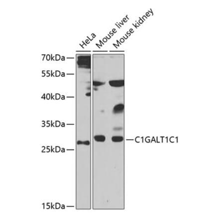Western Blot - Anti-COSMC Antibody (A15799) - Antibodies.com