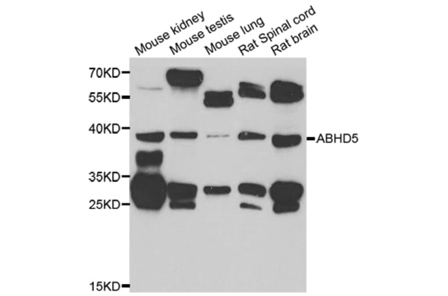 Western Blot - Anti-ABHD5 Antibody (A7592) - Antibodies.com