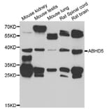 Western Blot - Anti-ABHD5 Antibody (A7592) - Antibodies.com