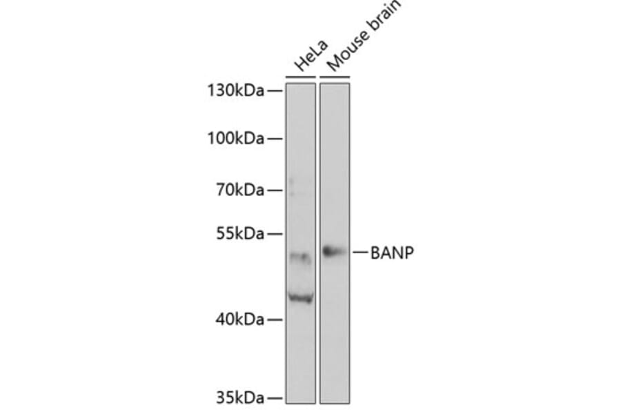 Western Blot - Anti-BANP Antibody (A15801) - Antibodies.com