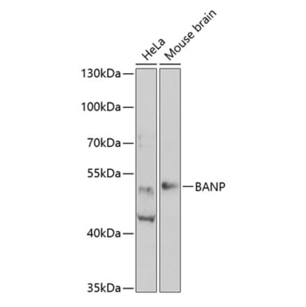 Western Blot - Anti-BANP Antibody (A15801) - Antibodies.com