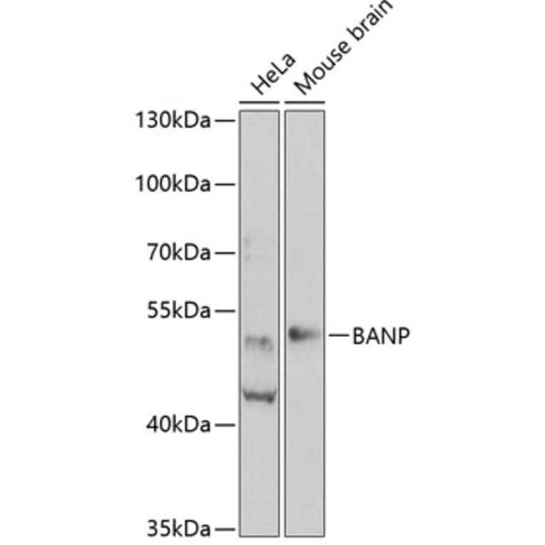 Western Blot - Anti-BANP Antibody (A15801) - Antibodies.com