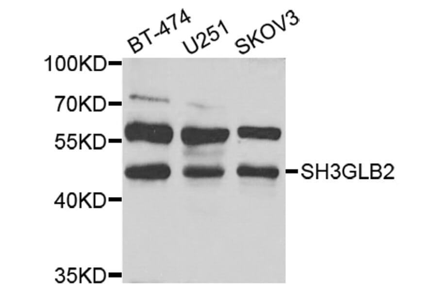 Western Blot - Anti-SH3GLB2 Antibody (A7599) - Antibodies.com