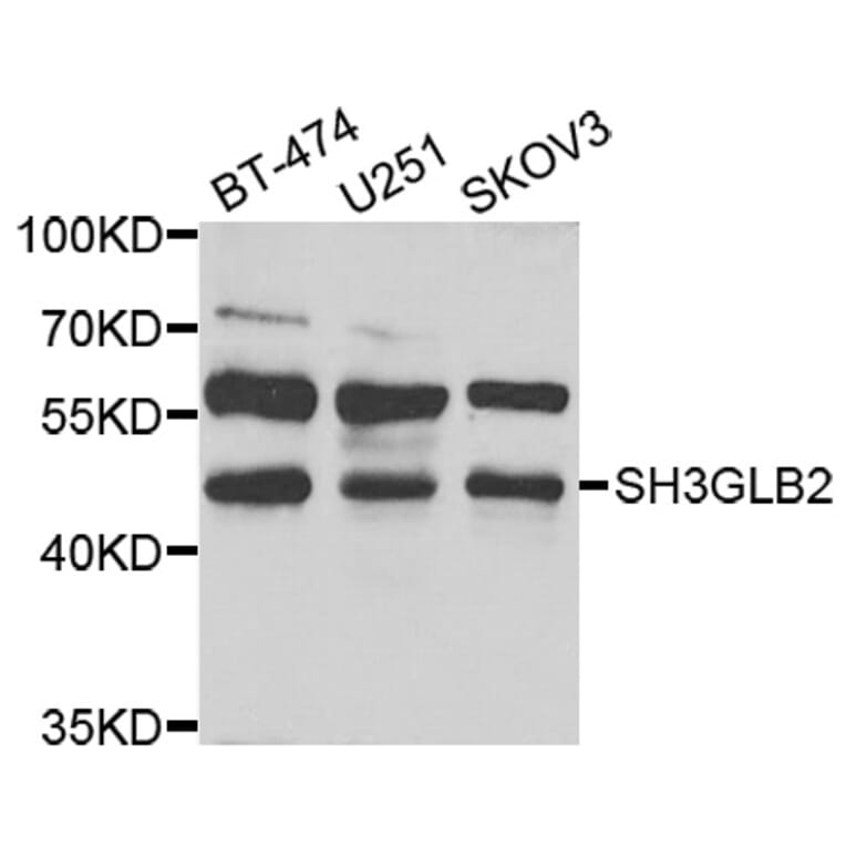 Western Blot - Anti-SH3GLB2 Antibody (A7599) - Antibodies.com