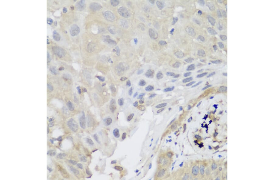 Immunohistochemistry - Anti-SH3GLB2 Antibody (A7599) - Antibodies.com
