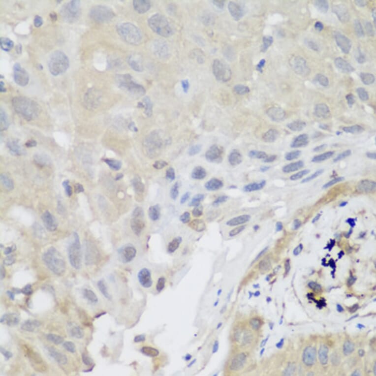 Immunohistochemistry - Anti-SH3GLB2 Antibody (A7599) - Antibodies.com