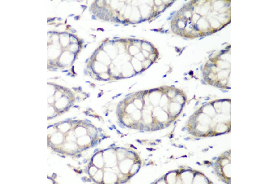 Immunohistochemistry - Anti-SH3GLB2 Antibody (A7599) - Antibodies.com