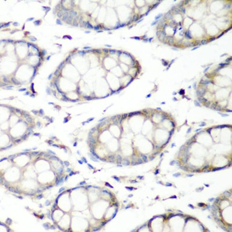 Immunohistochemistry - Anti-SH3GLB2 Antibody (A7599) - Antibodies.com
