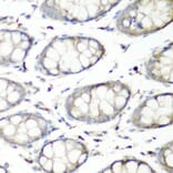 Immunohistochemistry - Anti-SH3GLB2 Antibody (A7599) - Antibodies.com