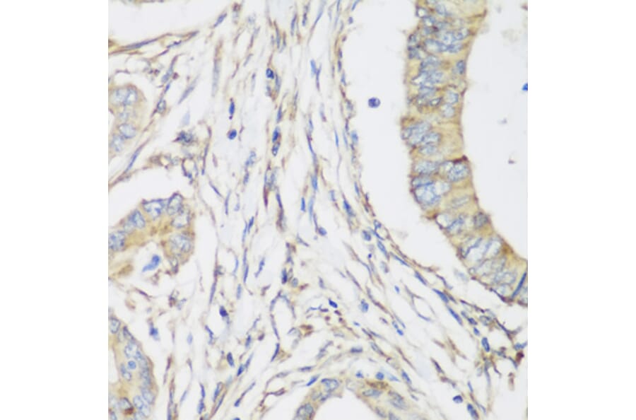 Immunohistochemistry - Anti-SH3GLB2 Antibody (A7599) - Antibodies.com