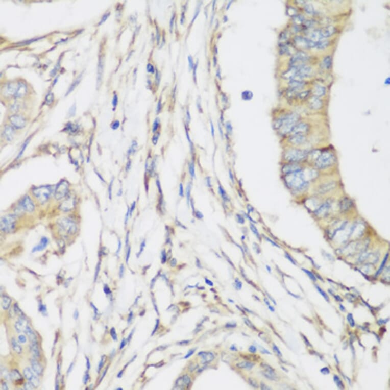 Immunohistochemistry - Anti-SH3GLB2 Antibody (A7599) - Antibodies.com