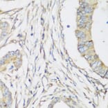 Immunohistochemistry - Anti-SH3GLB2 Antibody (A7599) - Antibodies.com