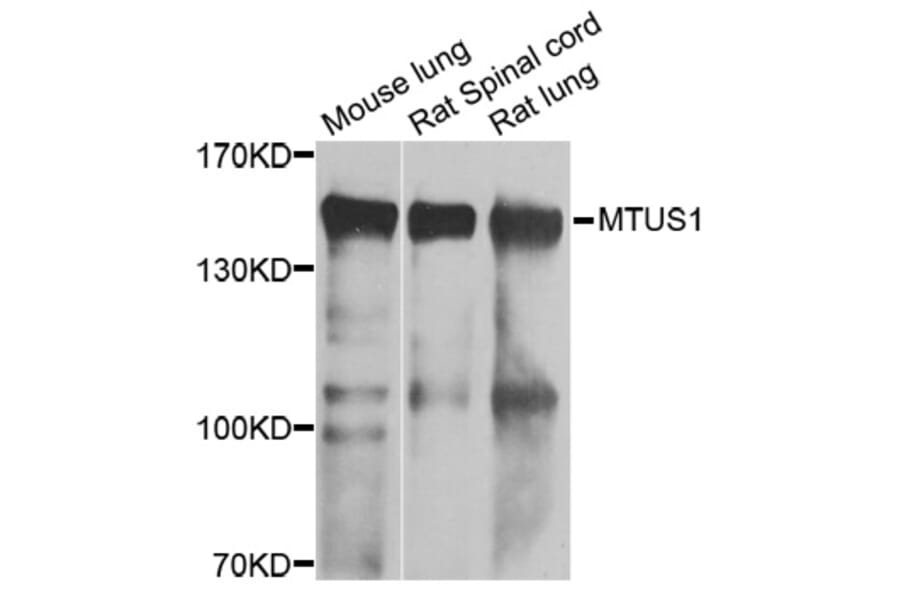 Western Blot - Anti-MTUS1 Antibody (A7601) - Antibodies.com