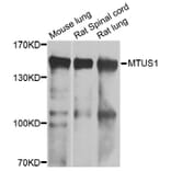 Western Blot - Anti-MTUS1 Antibody (A7601) - Antibodies.com