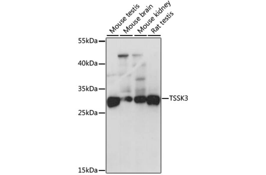 Western Blot - Anti-TSSK-3 Antibody (A15805) - Antibodies.com
