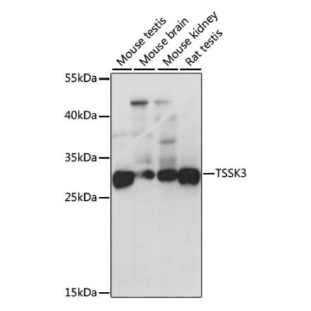 Western Blot - Anti-TSSK-3 Antibody (A15805) - Antibodies.com