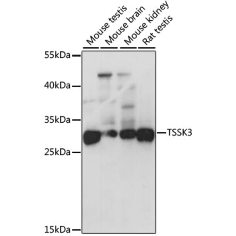 Western Blot - Anti-TSSK-3 Antibody (A15805) - Antibodies.com