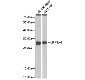 Western Blot - Anti-SPATA4 Antibody (A15807) - Antibodies.com