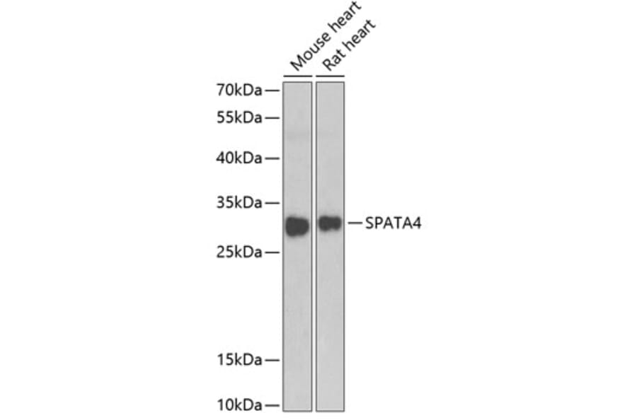 Western Blot - Anti-SPATA4 Antibody (A15807) - Antibodies.com
