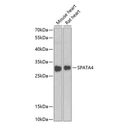 Western Blot - Anti-SPATA4 Antibody (A15807) - Antibodies.com