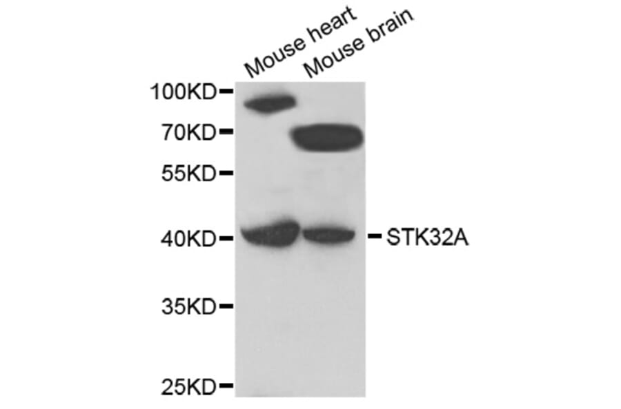 Western Blot - Anti-STK32A Antibody (A7613) - Antibodies.com