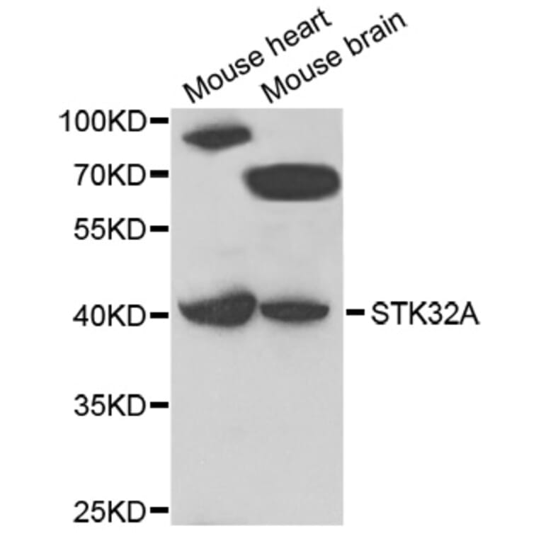 Western Blot - Anti-STK32A Antibody (A7613) - Antibodies.com