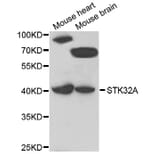Western Blot - Anti-STK32A Antibody (A7613) - Antibodies.com