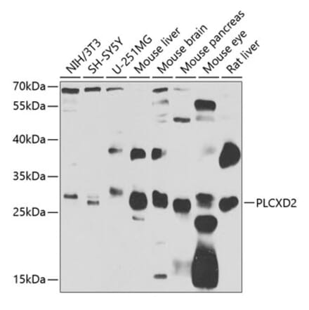 Western Blot - Anti-PLCXD2 Antibody (A15809) - Antibodies.com