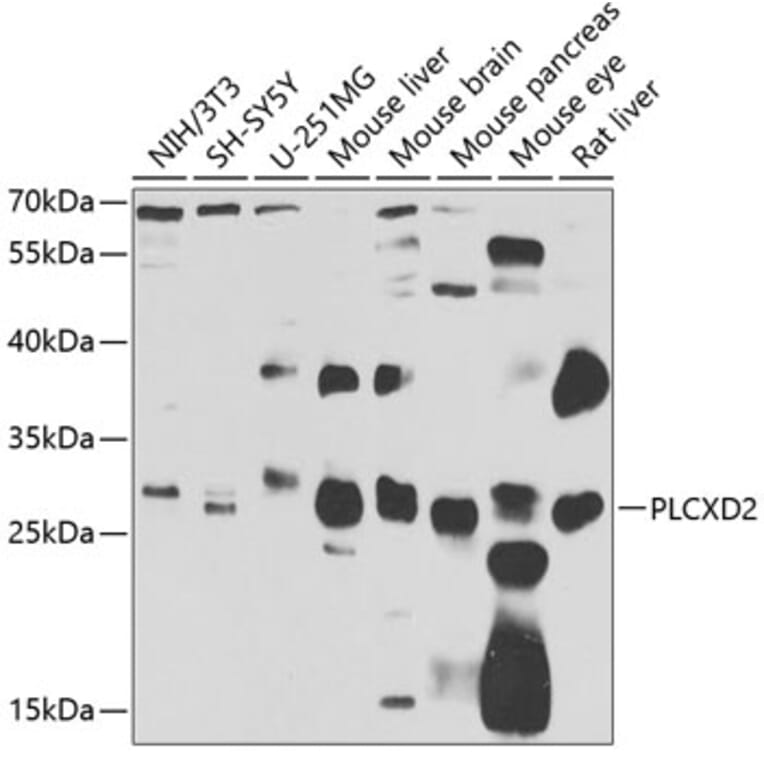Western Blot - Anti-PLCXD2 Antibody (A15809) - Antibodies.com