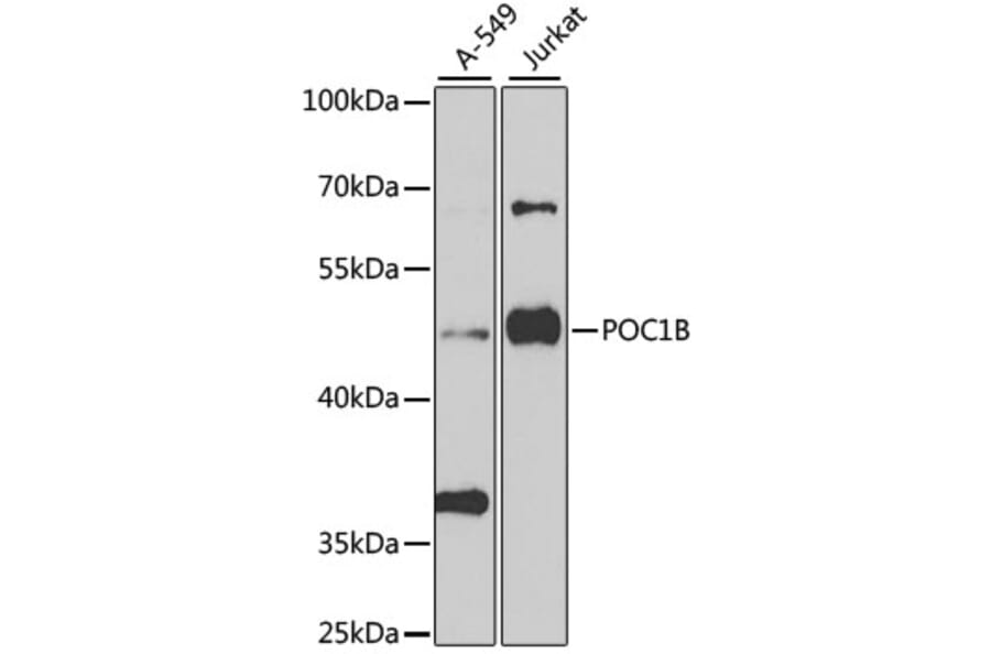 Western Blot - Anti-POC1B Antibody (A15810) - Antibodies.com