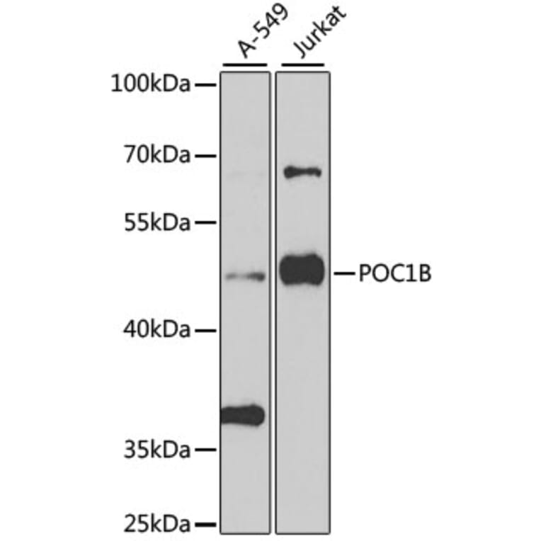 Western Blot - Anti-POC1B Antibody (A15810) - Antibodies.com
