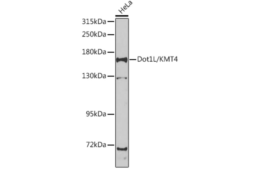Western Blot - Anti-KMT4 / Dot1L Antibody (A15811) - Antibodies.com