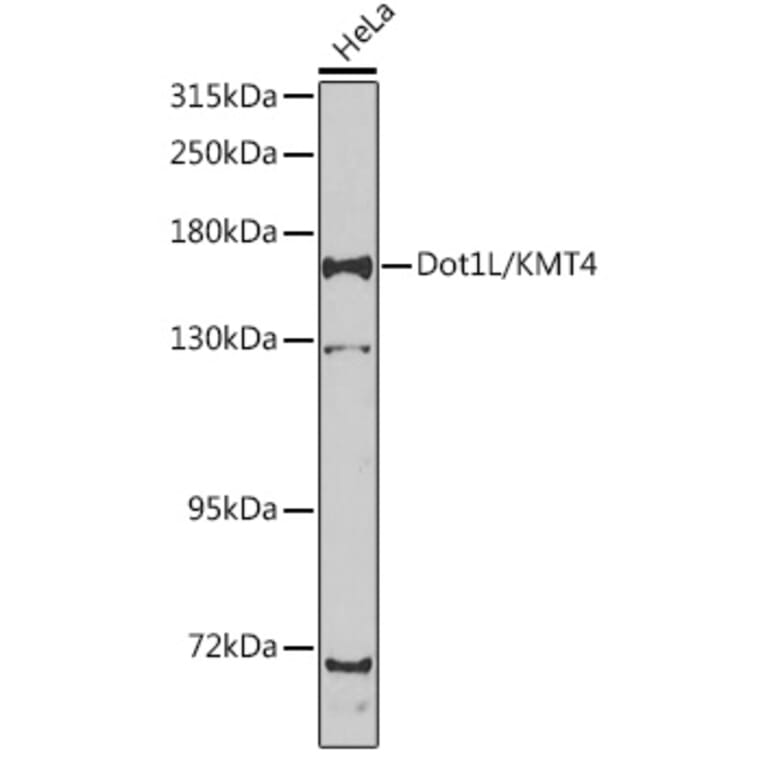 Western Blot - Anti-KMT4 / Dot1L Antibody (A15811) - Antibodies.com