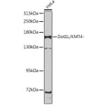 Western Blot - Anti-KMT4 / Dot1L Antibody (A15811) - Antibodies.com