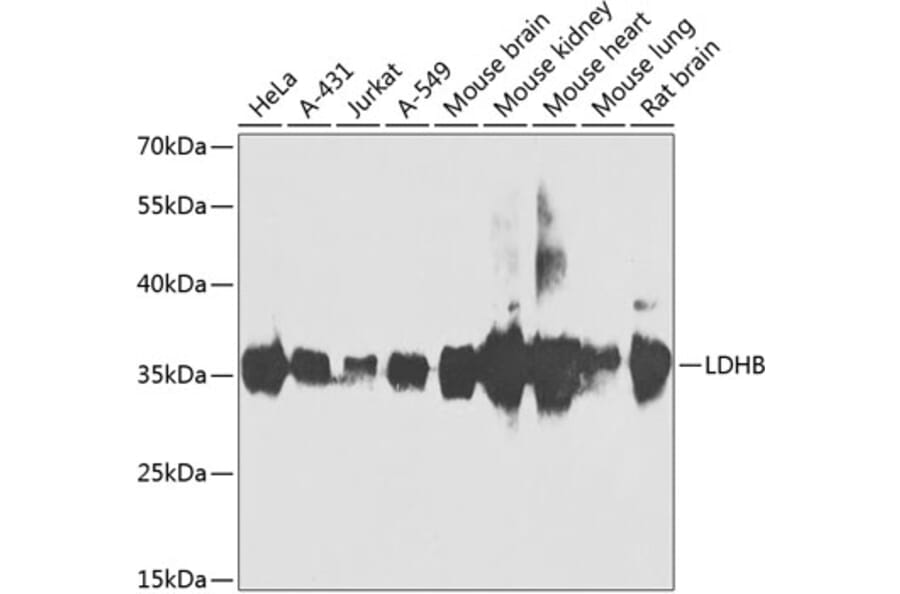 Western Blot - Anti-Lactate Dehydrogenase B/LDH-B Antibody (A15812) - Antibodies.com