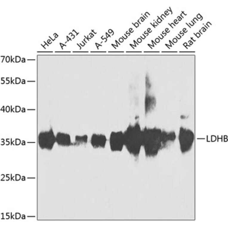 Western Blot - Anti-Lactate Dehydrogenase B/LDH-B Antibody (A15812) - Antibodies.com
