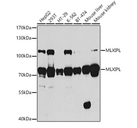 Western Blot - Anti-CHREBP Antibody (A15813) - Antibodies.com