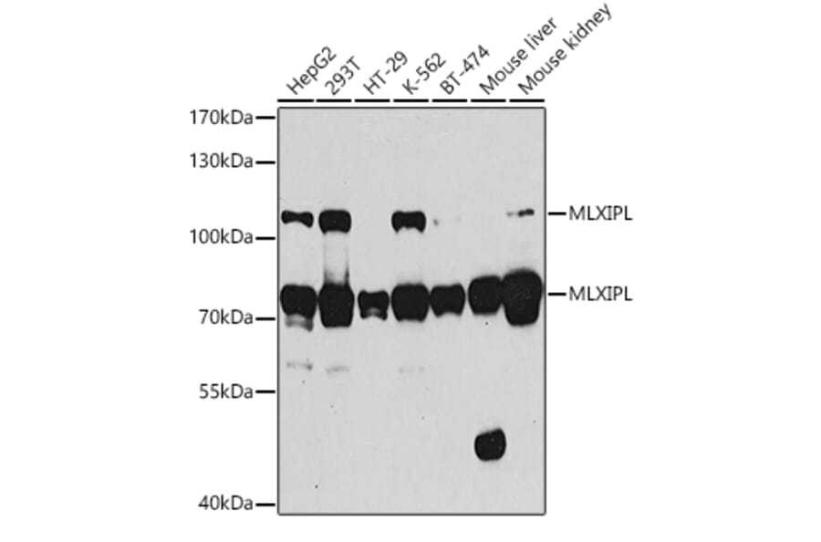 Western Blot - Anti-CHREBP Antibody (A15813) - Antibodies.com