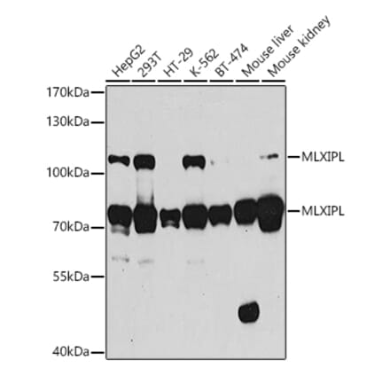 Western Blot - Anti-CHREBP Antibody (A15813) - Antibodies.com
