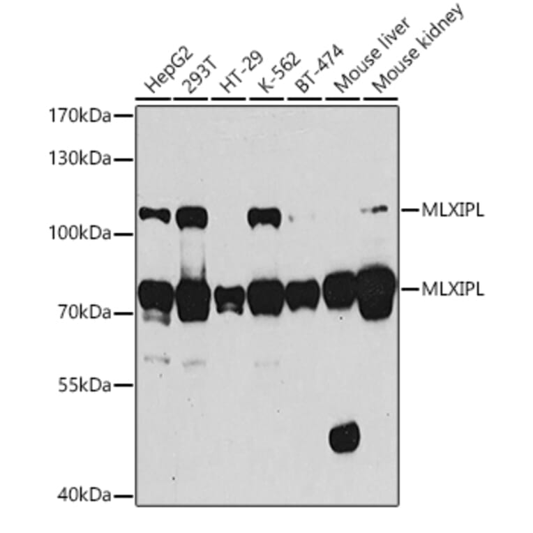 Western Blot - Anti-CHREBP Antibody (A15813) - Antibodies.com