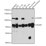 Western Blot - Anti-CHREBP Antibody (A15813) - Antibodies.com